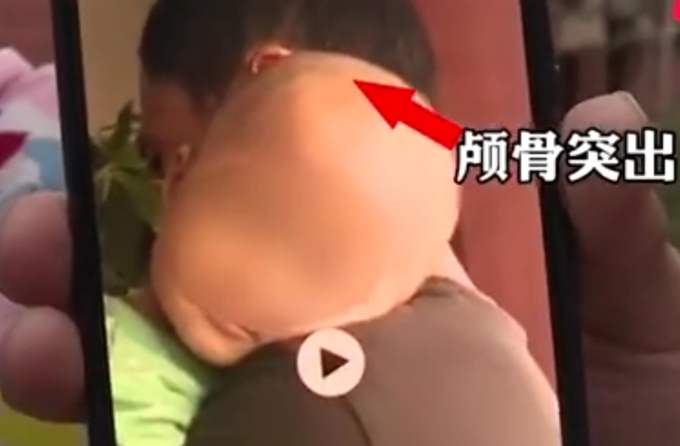 郴州推薦假奶粉涉事醫生被停職